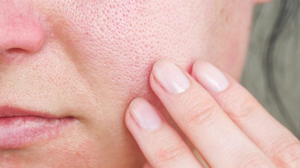 officieel Vul in Redding 8 Tips Om Poriën Te Verkleinen | Mineral Skin Cosmetics