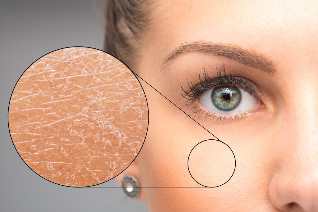Een Droge Huid Behandelen? 6 Dingen Die Je Moet Doen [+routine] | Mineral Skin Cosmetics